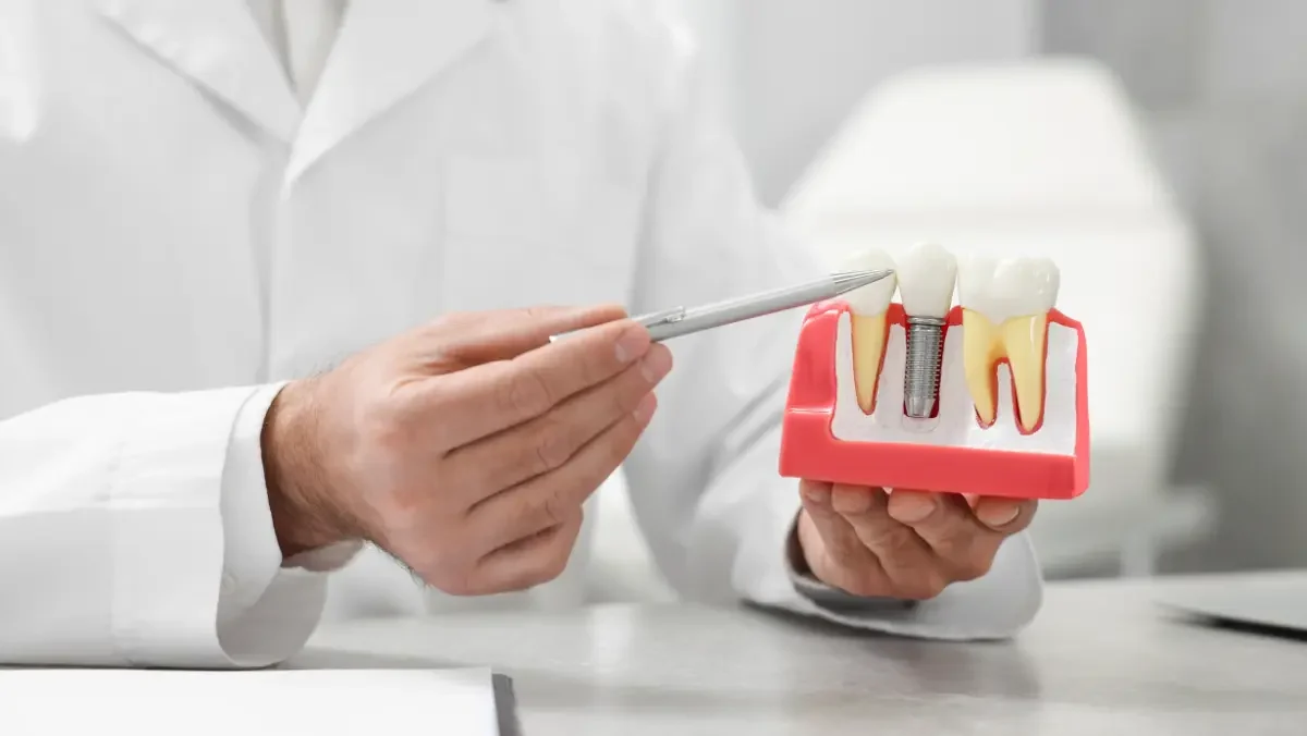 Dental Implants